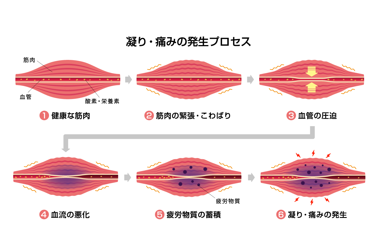 デコルテとバストの美しさを支える首の筋肉ケア